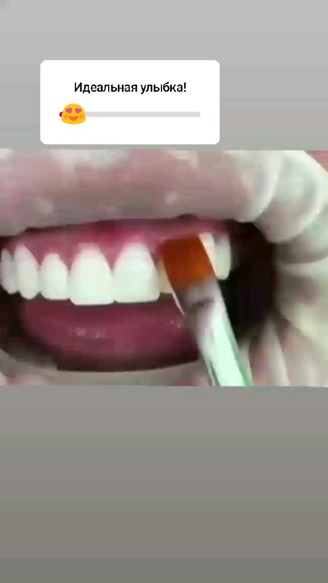 До/После - результат лечения