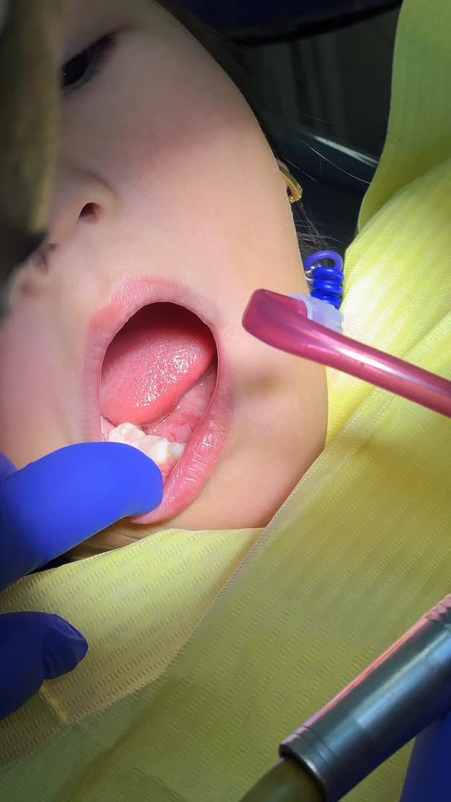 Детская стоматология