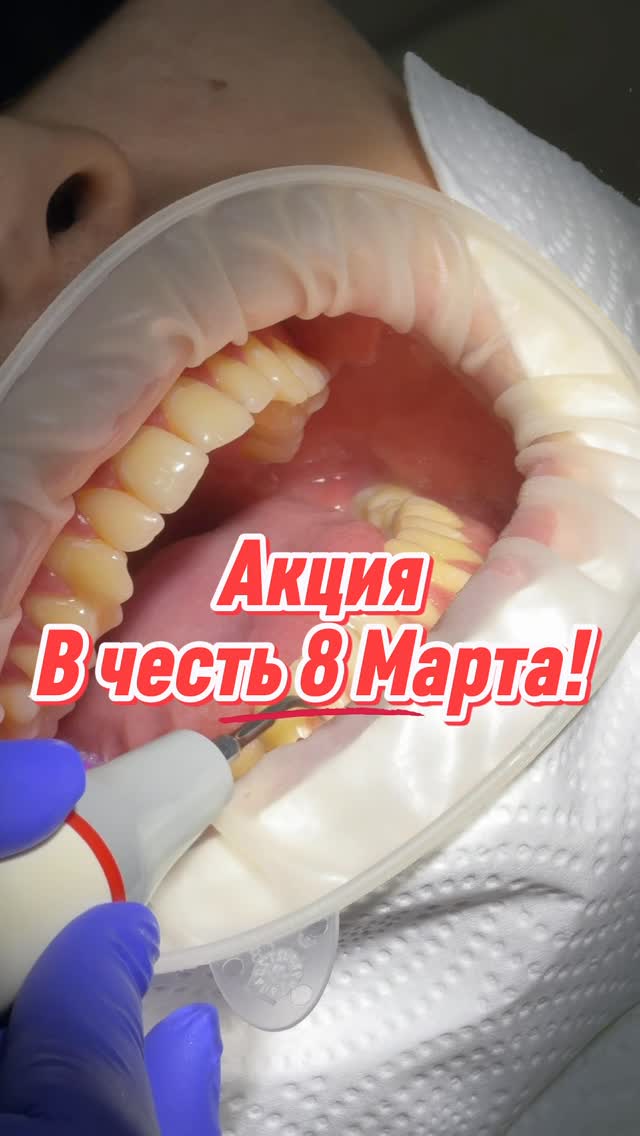 Имплантация зубов